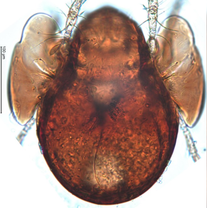 02_한국미기록종 Trichogalumna boninensis Hagino, Bayartogtokh & Shimano, 2017.jpg